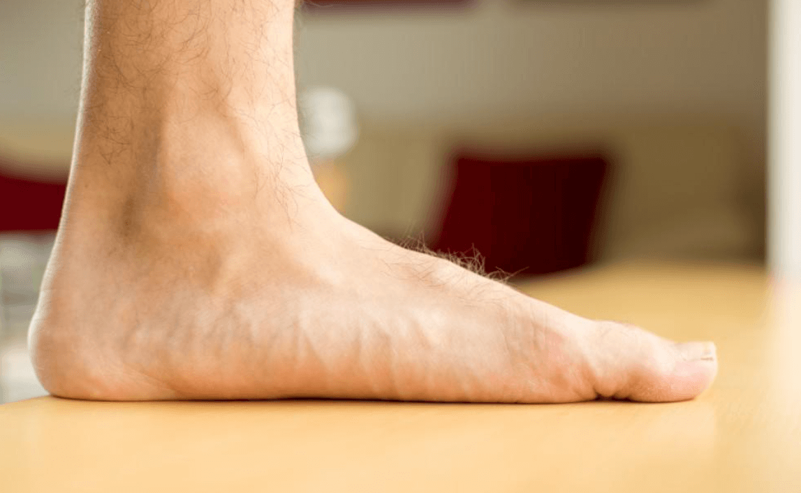 Can Having Flat Feet Cause Back Problems 