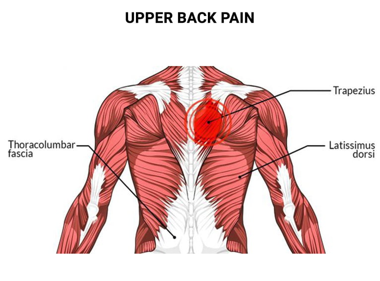 Upper Back Pain Doctors NJ NYC Back Pain Injury Treatments